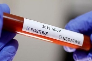 Egypt_Coronavirus_report_Monday.jpg