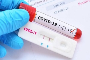 Egypt_reports_921_coronavirus_cases.jpg