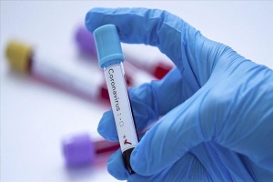 coronavirus_report_egypt.jpg