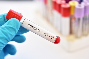 egypt_reports_new_covid_19_cases.jpg (1)